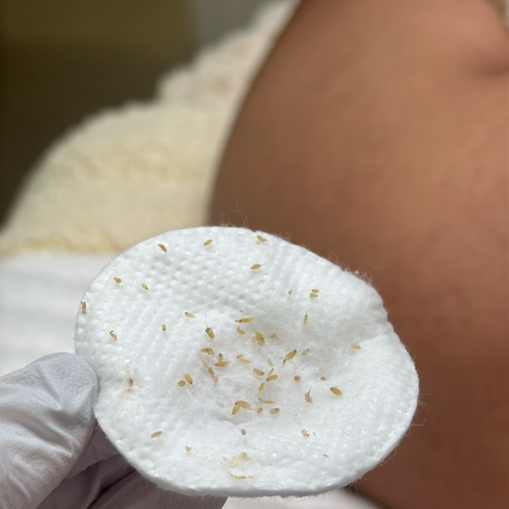 Acne Bootcamp 🫧 at The Spot Beauty in Phoenix, AZ