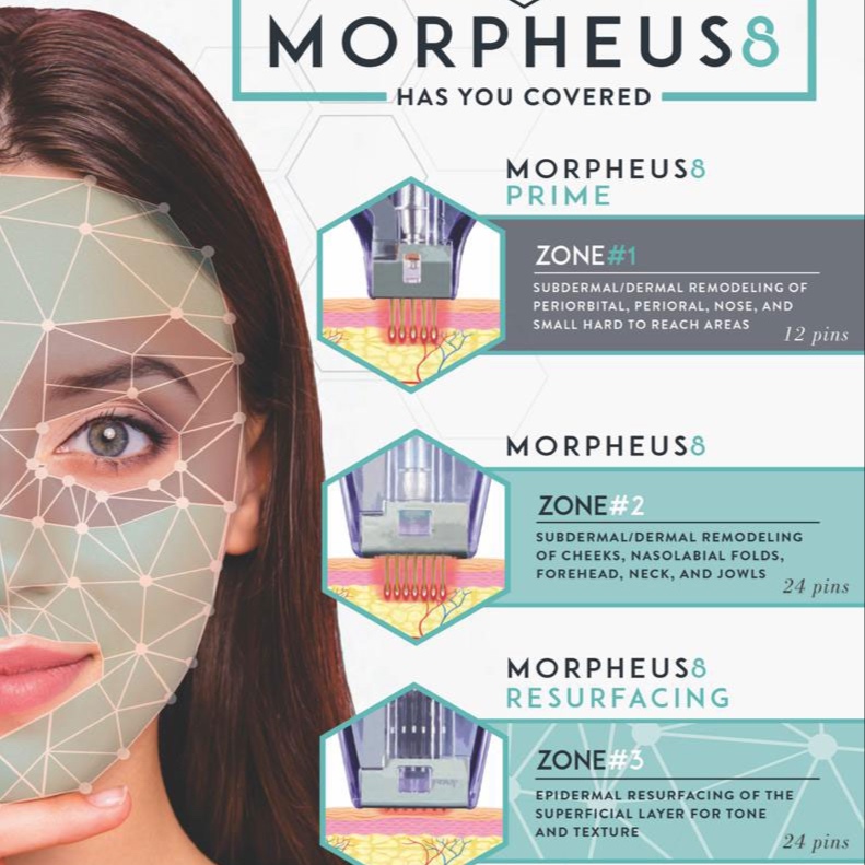 Morpheus8 Face Or Neck at Balance MedSpa & Salon in BEVERLY HILLS, FL