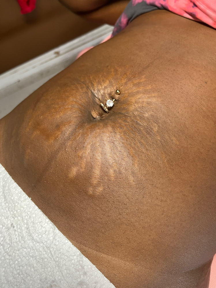Stomach Strip Wax