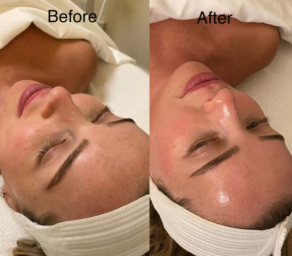 Elite Facials 💆 at Elite Luxe  MedSpa and Cosmetics in Houston, TX