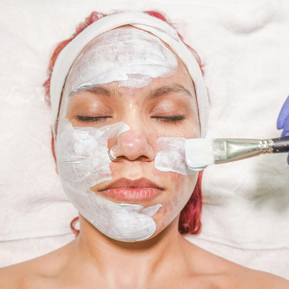 Chemical Peel at Flow and Glow RN in Corona, CA