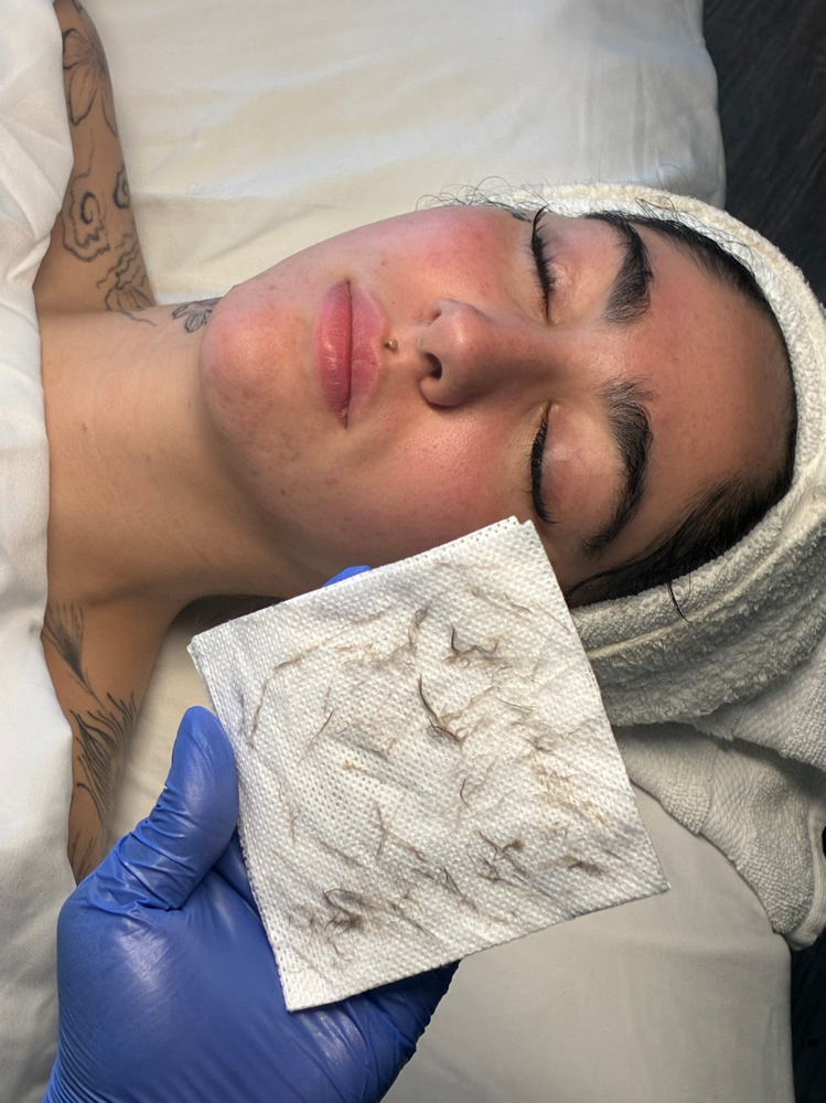 Dermaplane Express