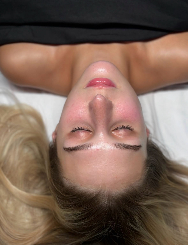 Microdermabrasion Facial