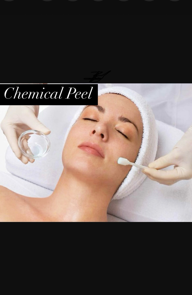 Chemical Peel