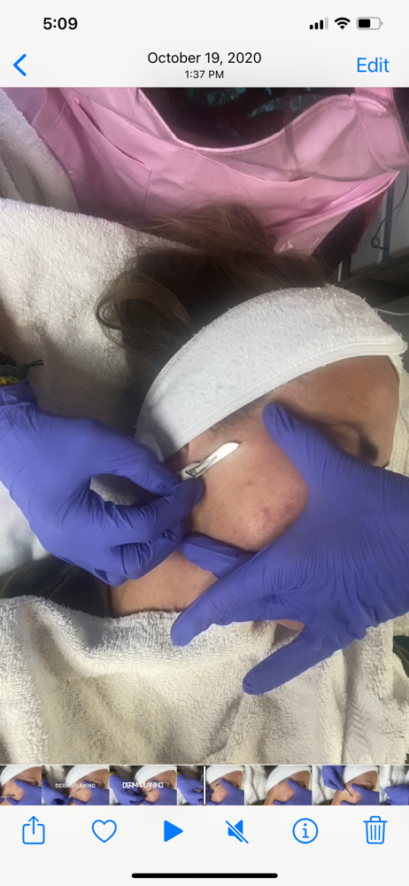 Dermaplane Facial