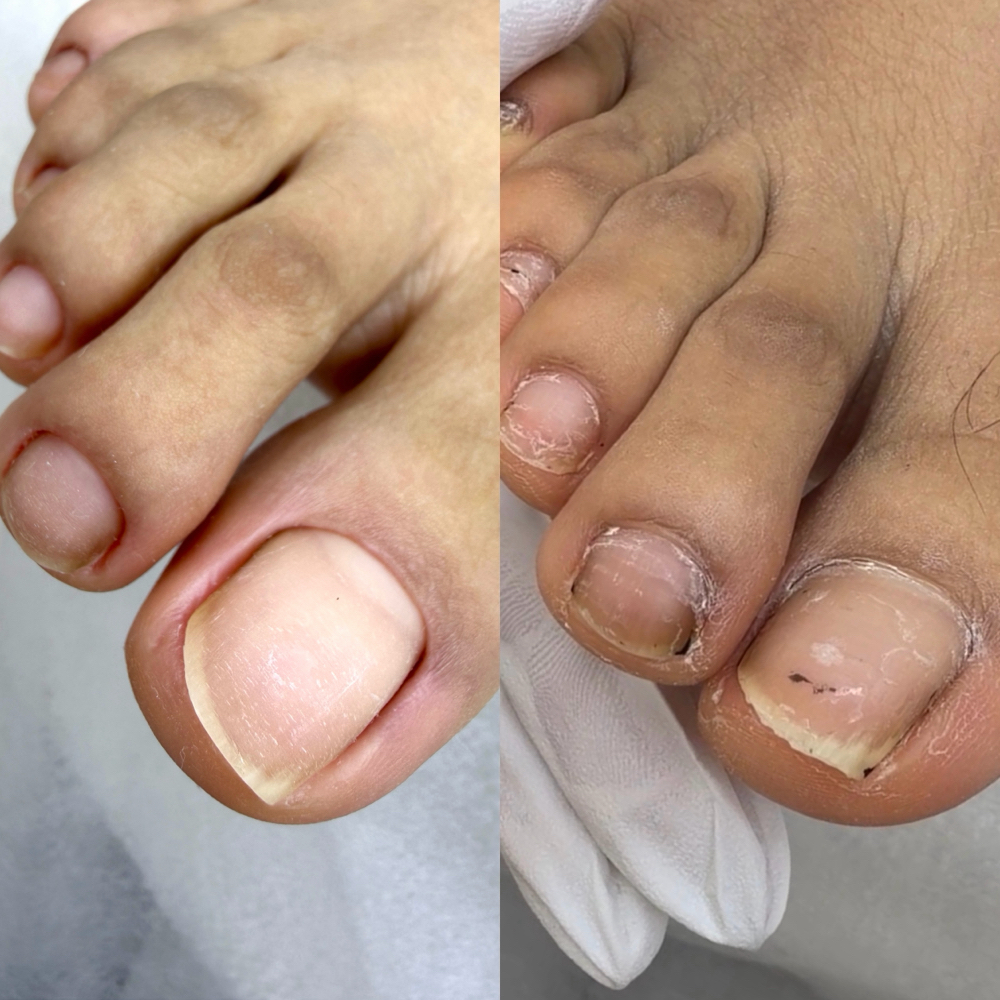Dry Pedicura Profilaxis at Dream Nails By Katterine in Corona, NY