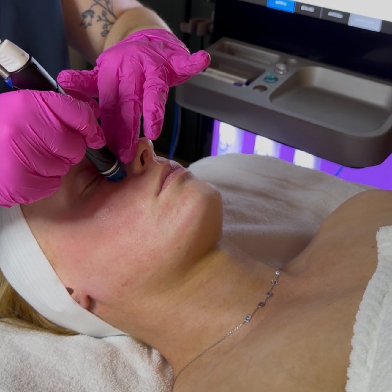 Express Hydrafacial at Luxe Lineage Esthetics in Christiansburg, VA