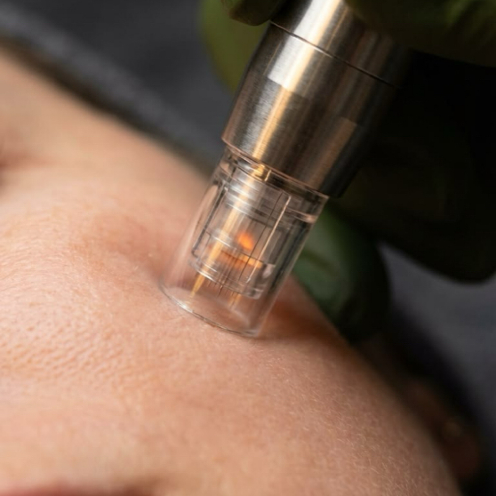 Microneedling at Nirvana Skincare & Aesthetics in Missouri City, TX