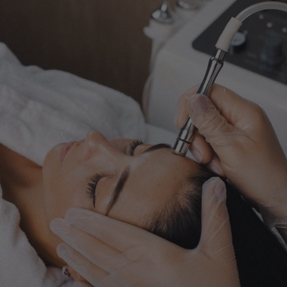 Microdermabrasion Facial ♡