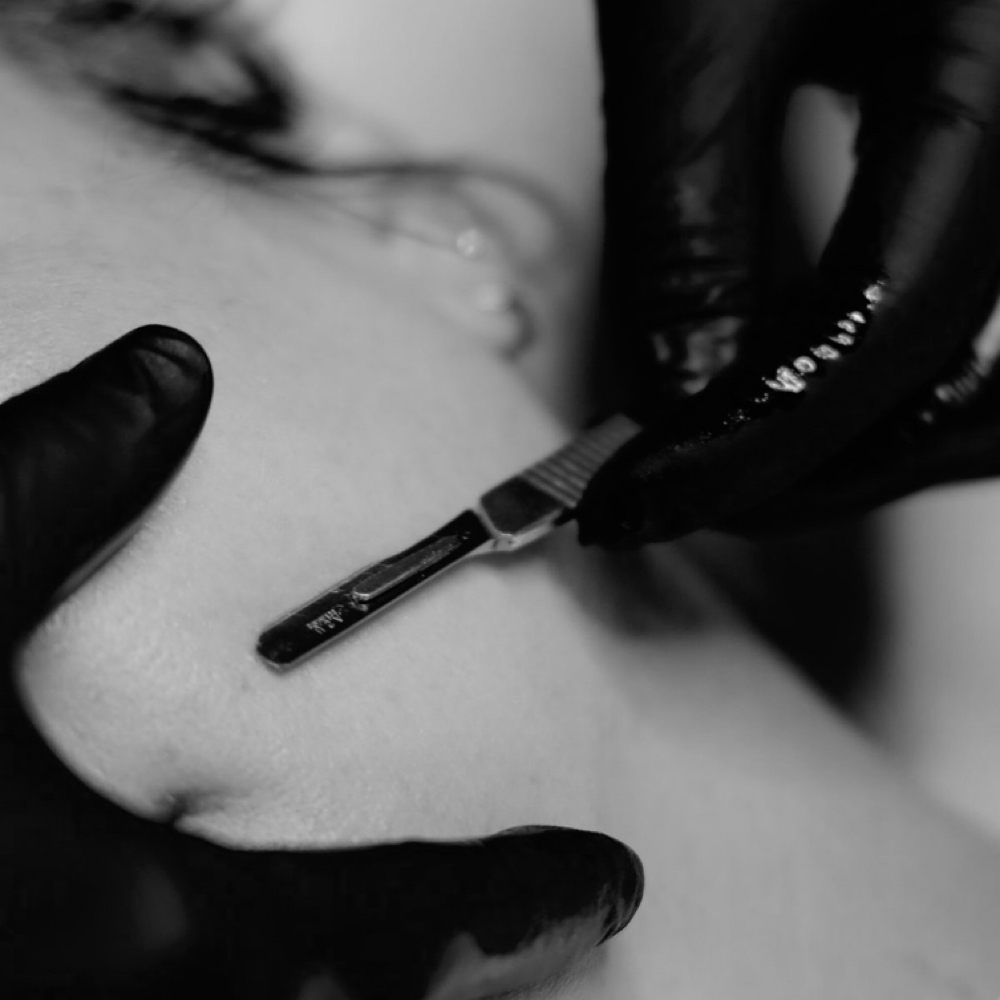 The Dermafacial at Halo + Honey Skin Studio in Corpus Christi, TX