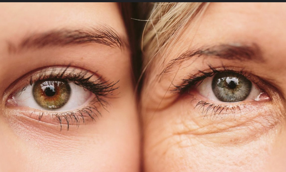 Microneedling