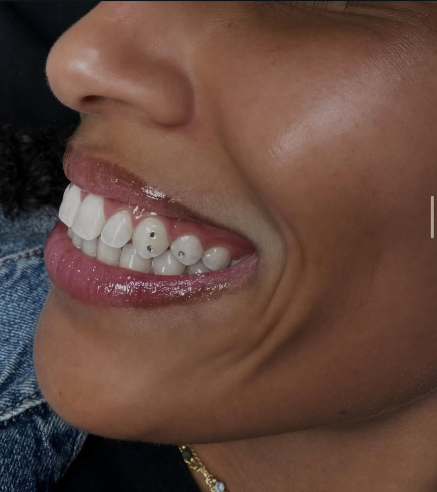 Three Tooth Gems