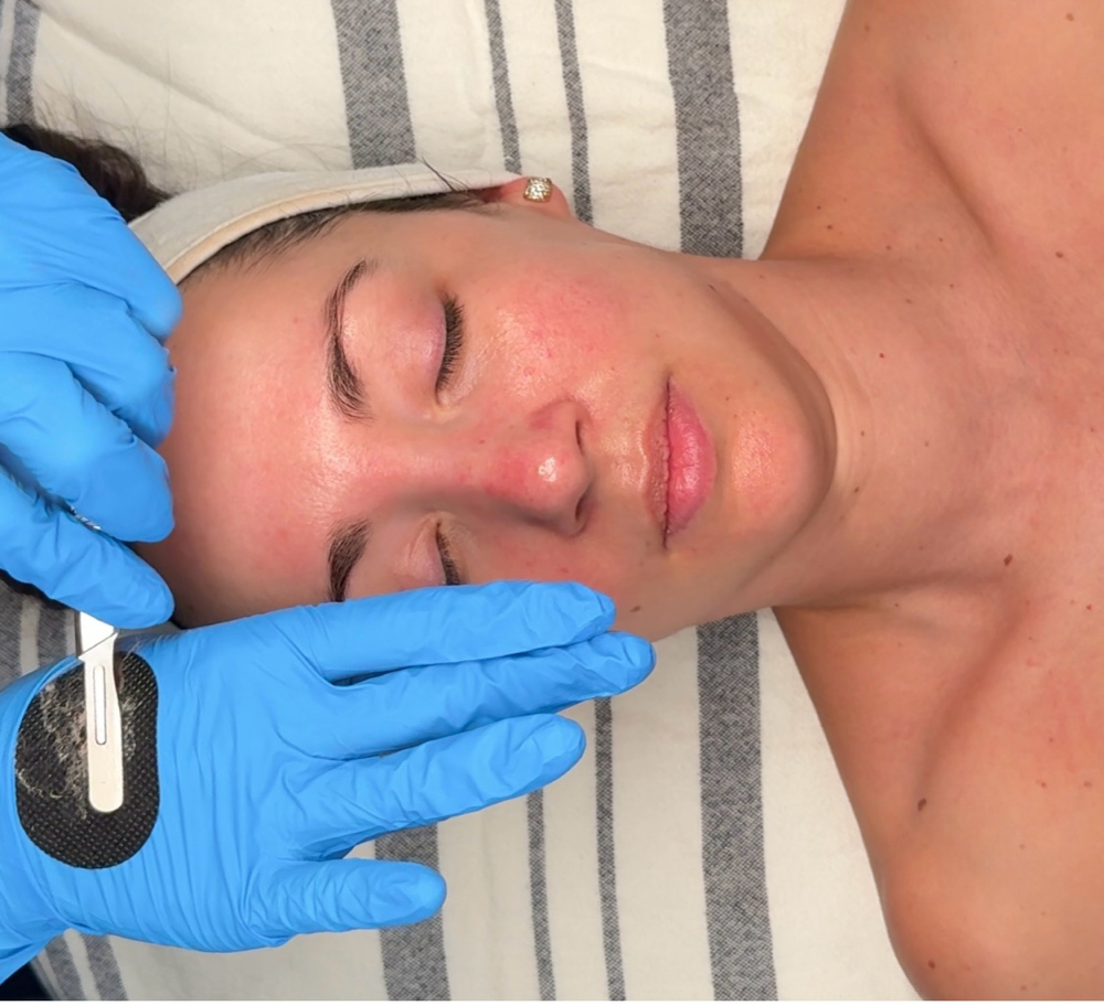 The Dermaplane Glow Facial