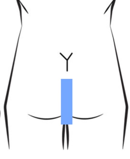 Butt Strip P