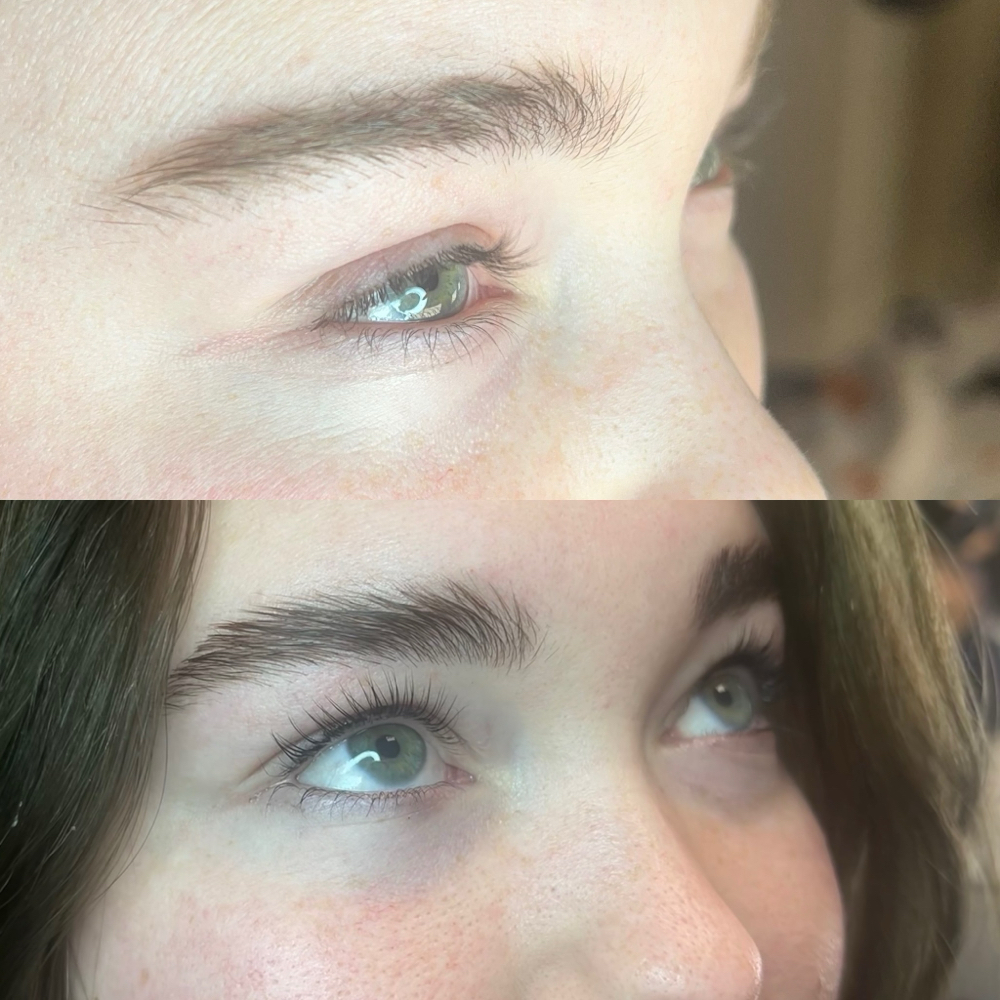 Eyelash lift