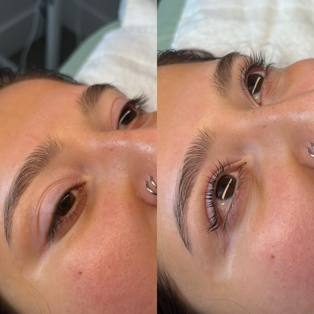 Eyelash lift