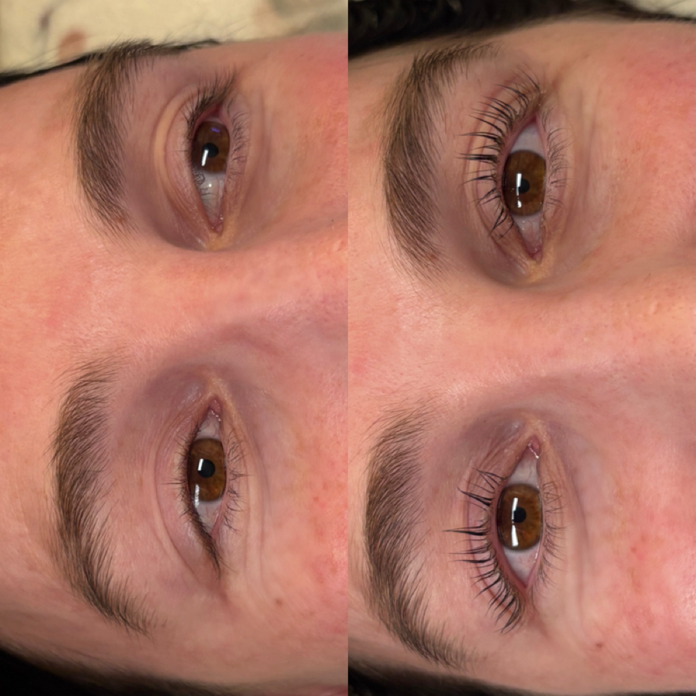 Eyelash lift