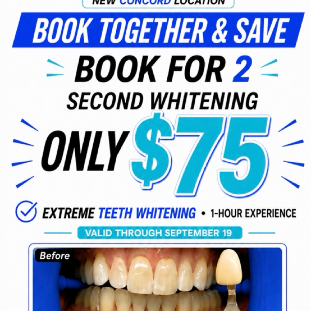 BOOK FOR 2 — 2nd Whitening Only $75 at Royal Blanc Smiles - Teeth Whitening and Tooth Gems in Charlotte, NC in Concord, NC