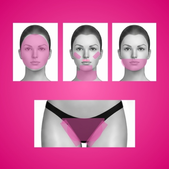 Buy 3 + 1 Free - Large Area at Silk Lasers in Winter Park, FL