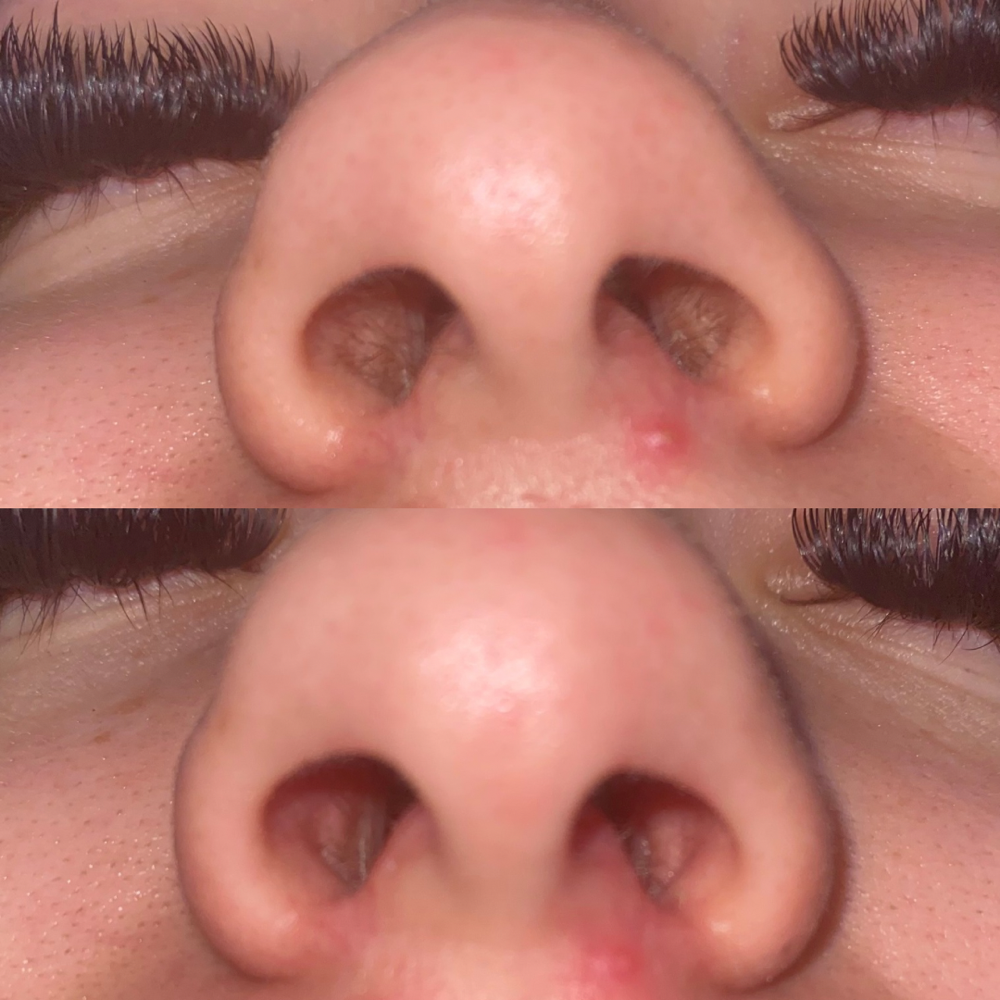 Nose