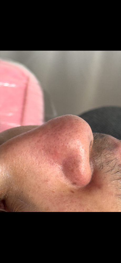 Deep Facial Cleansing at MR Beauty in Peabody, MA