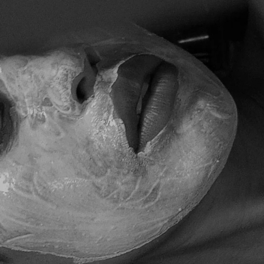 100 Minute Custom Facial at Midnight Aesthetics in Portland, OR