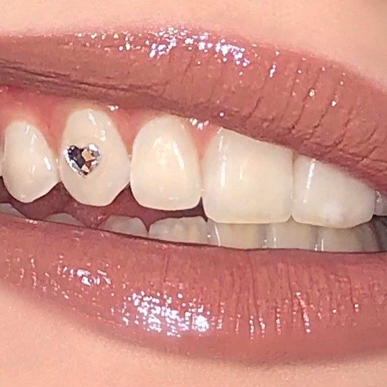 Tooth Gem 💎