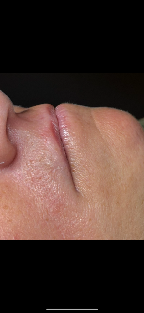 Upper Lip at Bare&bloom wax in Gansevoort, NY