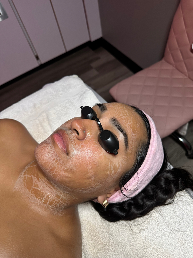🎄NO-TOX FACIAL