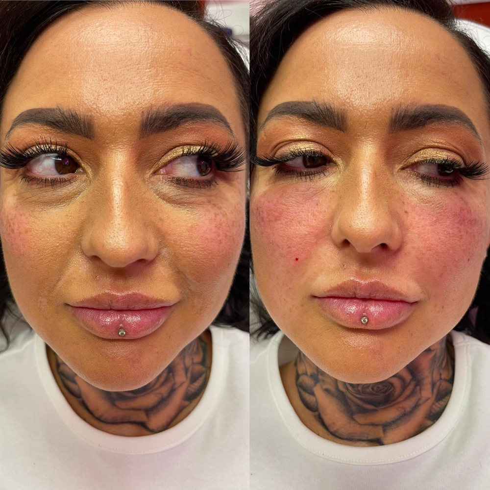 UnderEye at Lips And Hips Beauty Bar in Modesto, CA