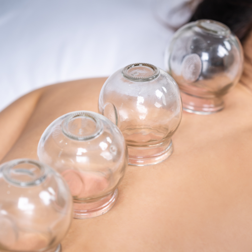 30 MIN CUPPING at Star Spa Lash & Brow By: Evelyn Esthetician in Oakland, NJ