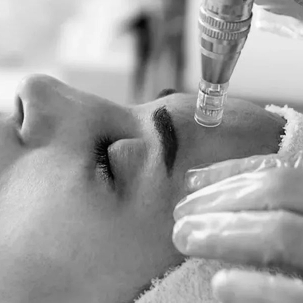 MICRONEEDLING at Gilded Sage in Portland, OR