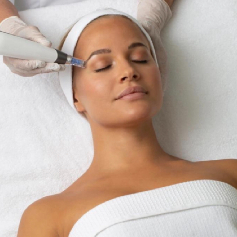Exosome Microneedling — Face + Neck at Sunshine Esthetics Lounge in Lake Mary, FL