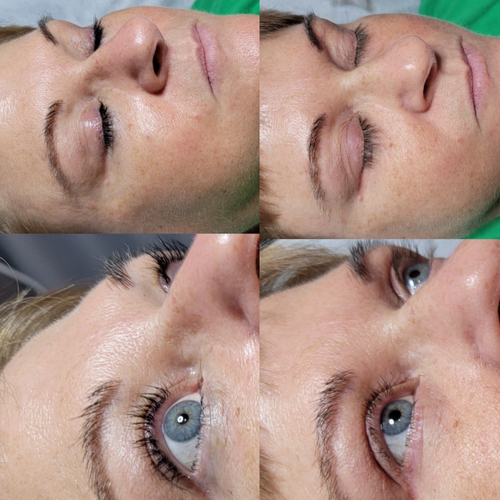 Lash Lift