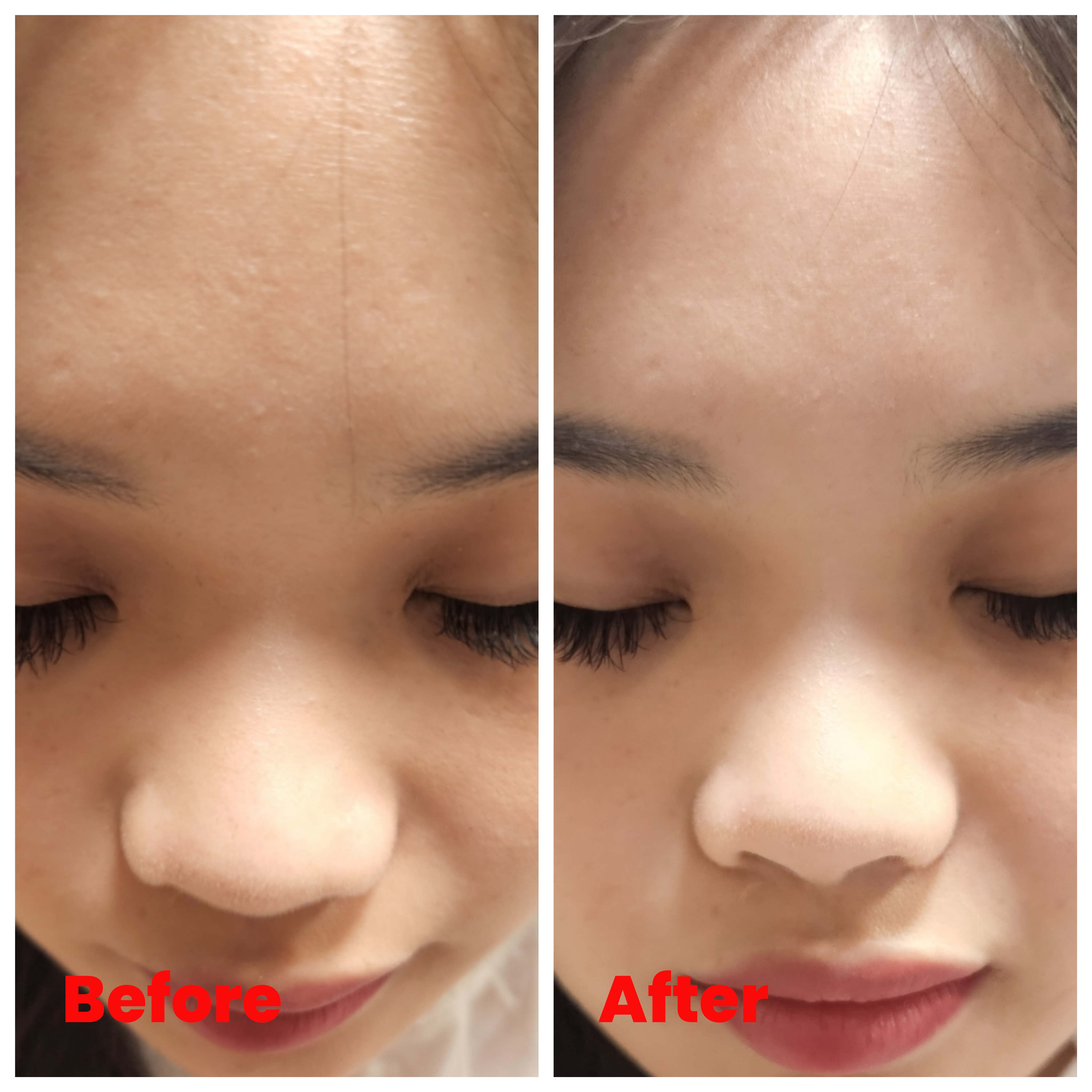 Brightening Facial
