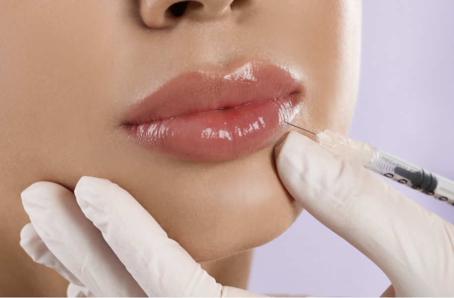 “Full Plump” Lip Filler