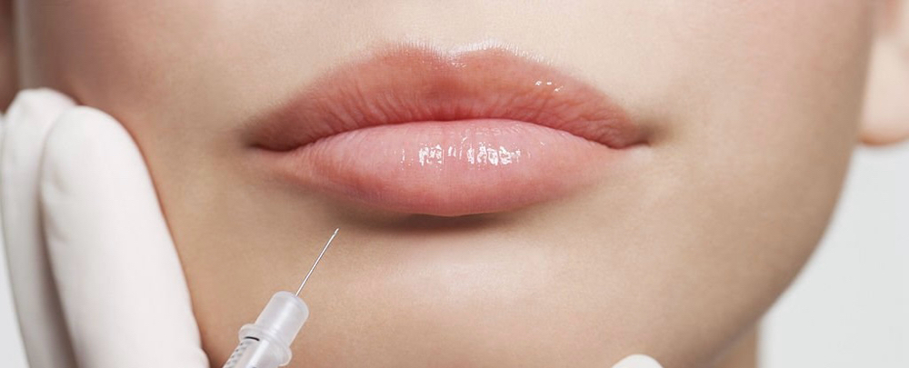 Botox ® Cosmetic - Lip Flip