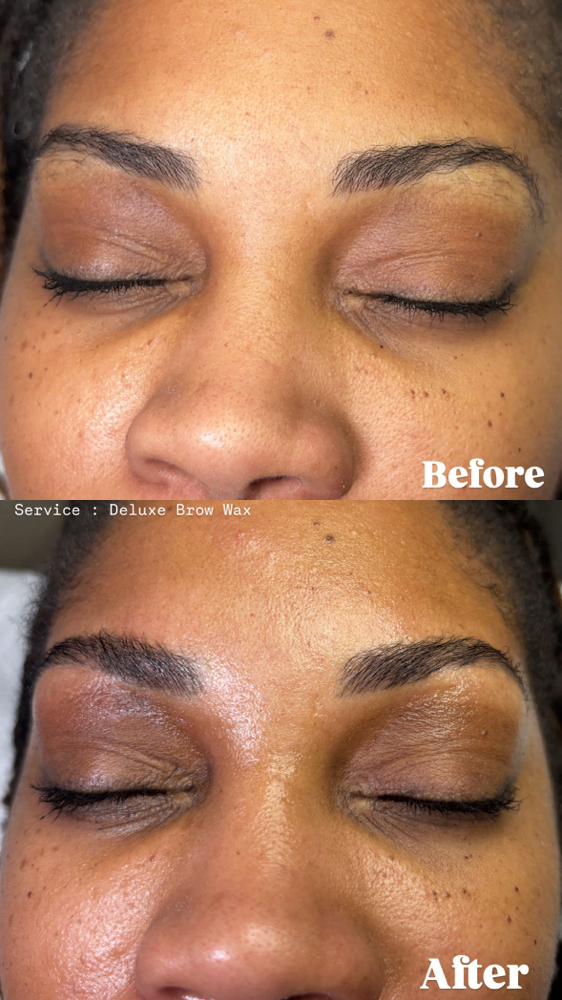 Brow , Lip and Chin Combo