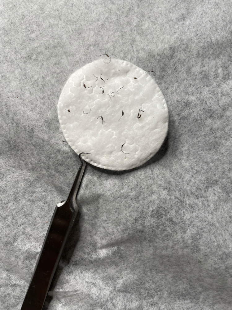 Extractions
