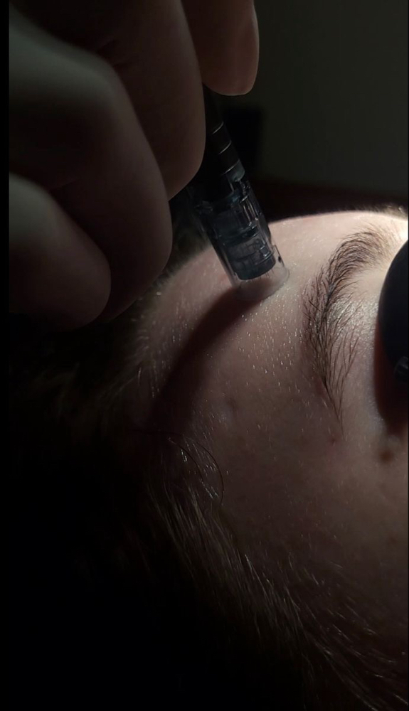 The NanoGlow Infusion Facial