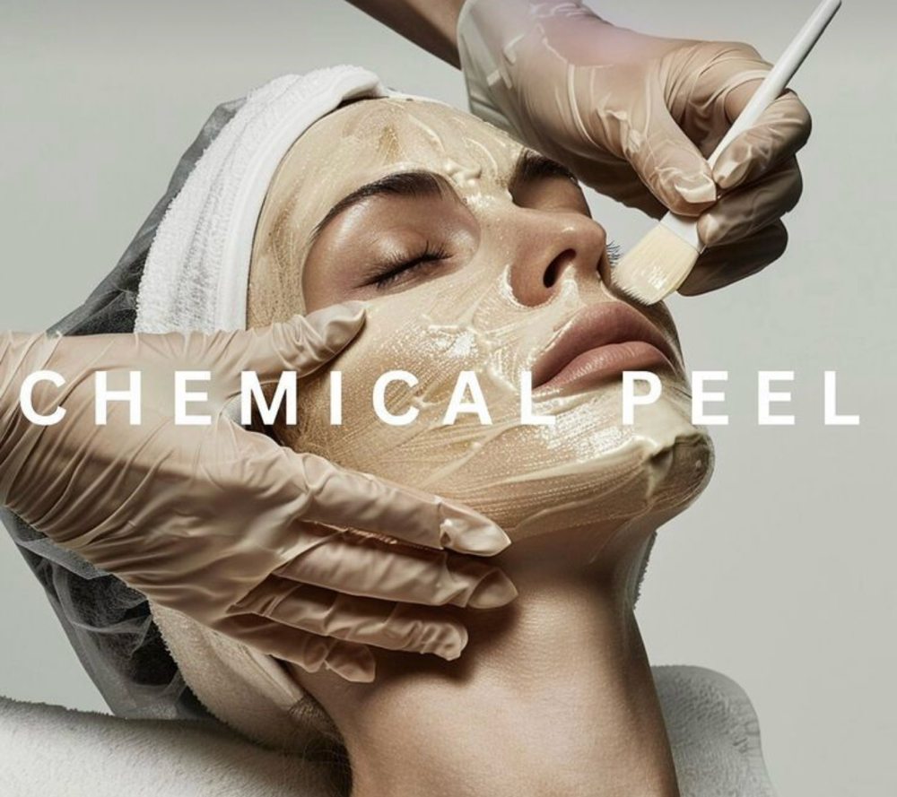 Chemical Peels