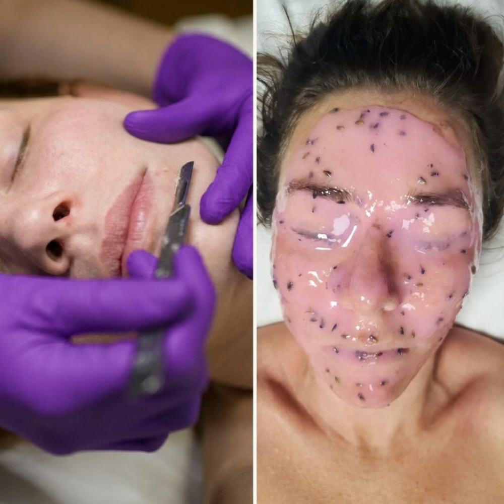 Dermaplane Facial at Serene Gatherings
