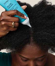 Dry Scalp Treatment