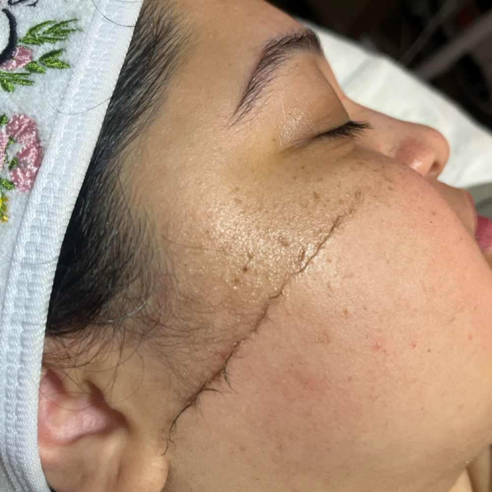 Dermaplane ONLY (no facial) at CC's House of Esthetics in Camarillo, CA