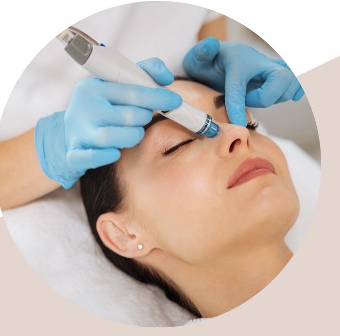 Microdermabrasion + HydroFacial