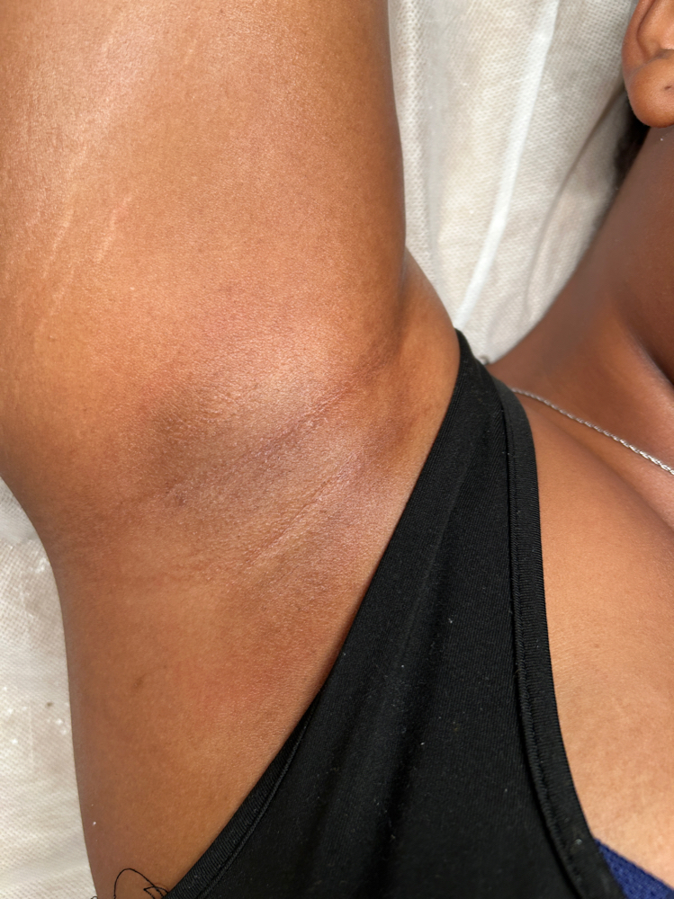 Under Arm
