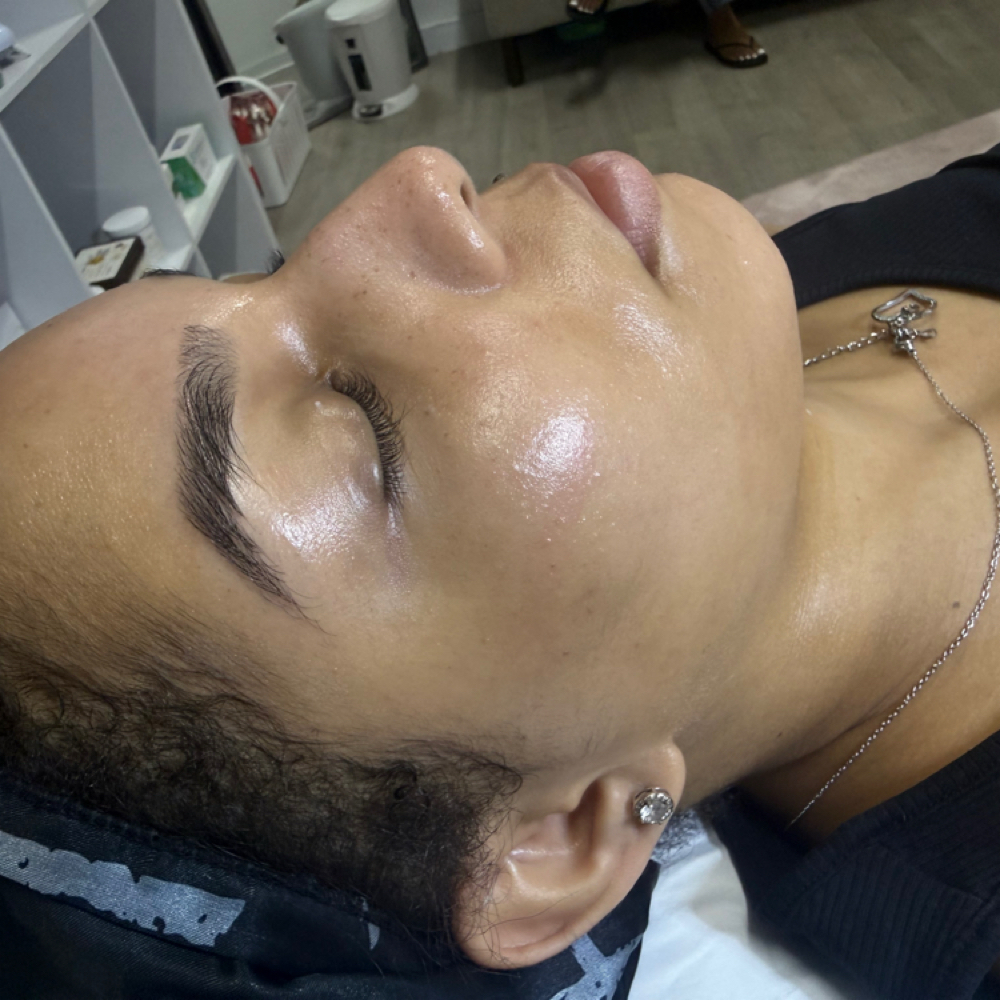 Dermaplan Facial at The Vanity Club in Atlanta, GA