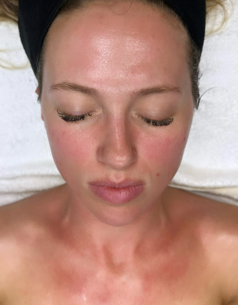 Ciao Glow + Restore (Full Body) at Ciao Bellä Esthetics WNC in Asheville, NC