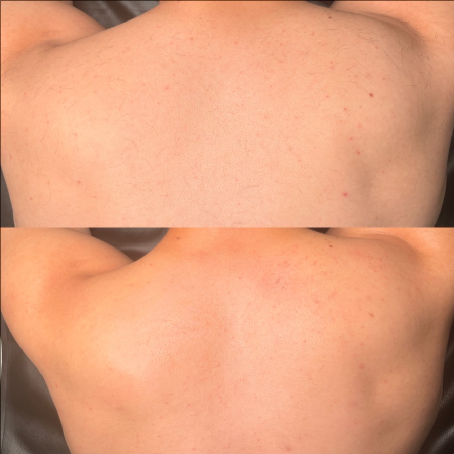 Back Wax at Moss & Moon in Pflugerville, TX
