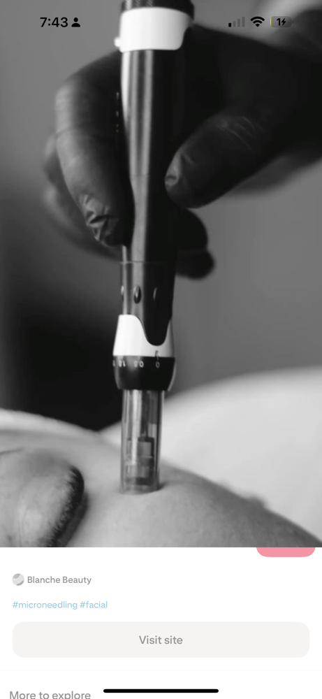 Microneedling at KayLuxAesthetics in Fuquay-Varina, NC